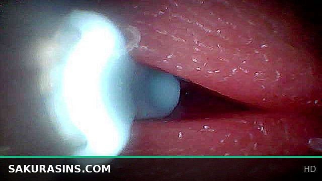 Penis Interior Sperm Journey: Unbelievable Endoscopic View