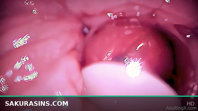 Condom Creampie Caught Inside Vagina with Hidden Camera Footage