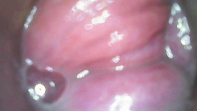 Endoscope Deep Inside Me: Dripping Wet and Filled with Cum