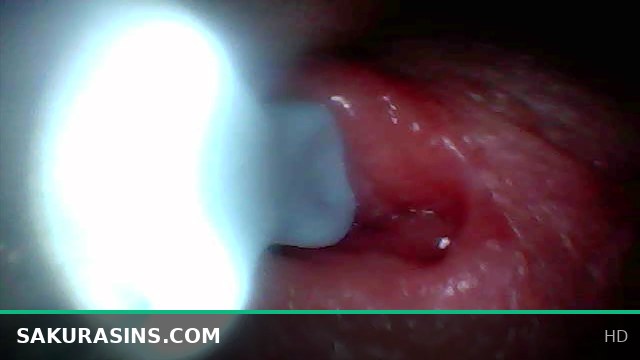 Endoscope Camera Captures Intense Male Ejaculation from Inside