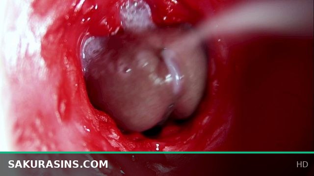 A Juicy Hole Overflowing with Thick White Cum