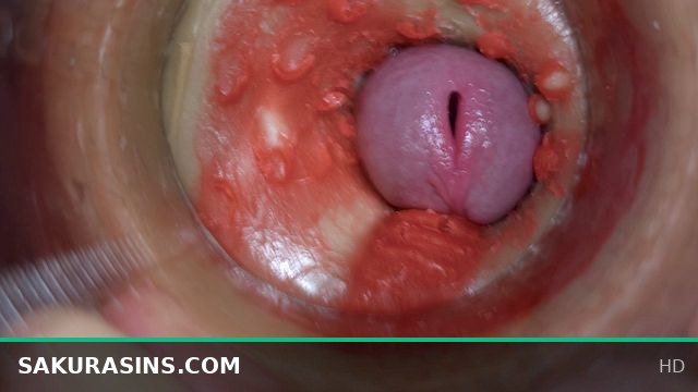 4K Camera Inside Deep Pussy Captures Massive Sperm Ejaculation