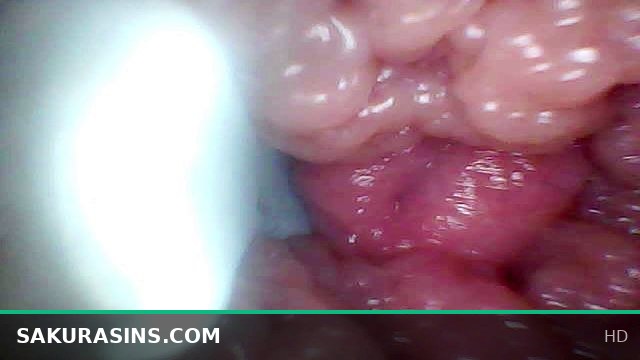 Endoscope Camera Captures My Wife’s G-Spot Stimulation - Educational JAV Video